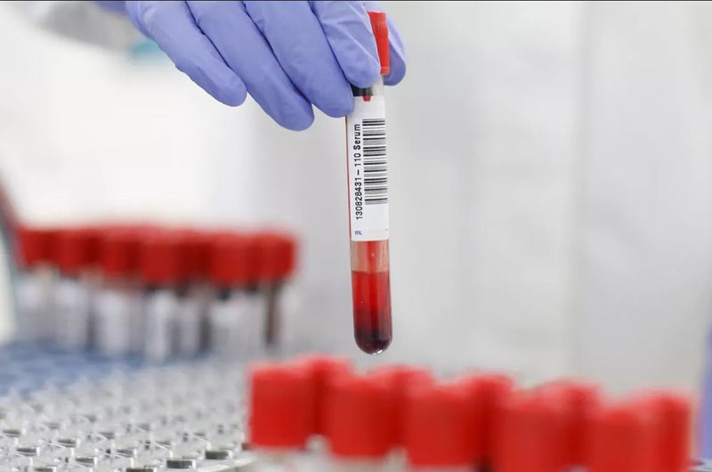 Department of Serology