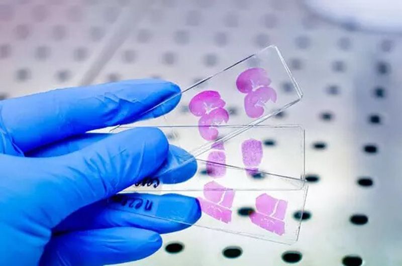 Department of Histopathology & Cytopathology